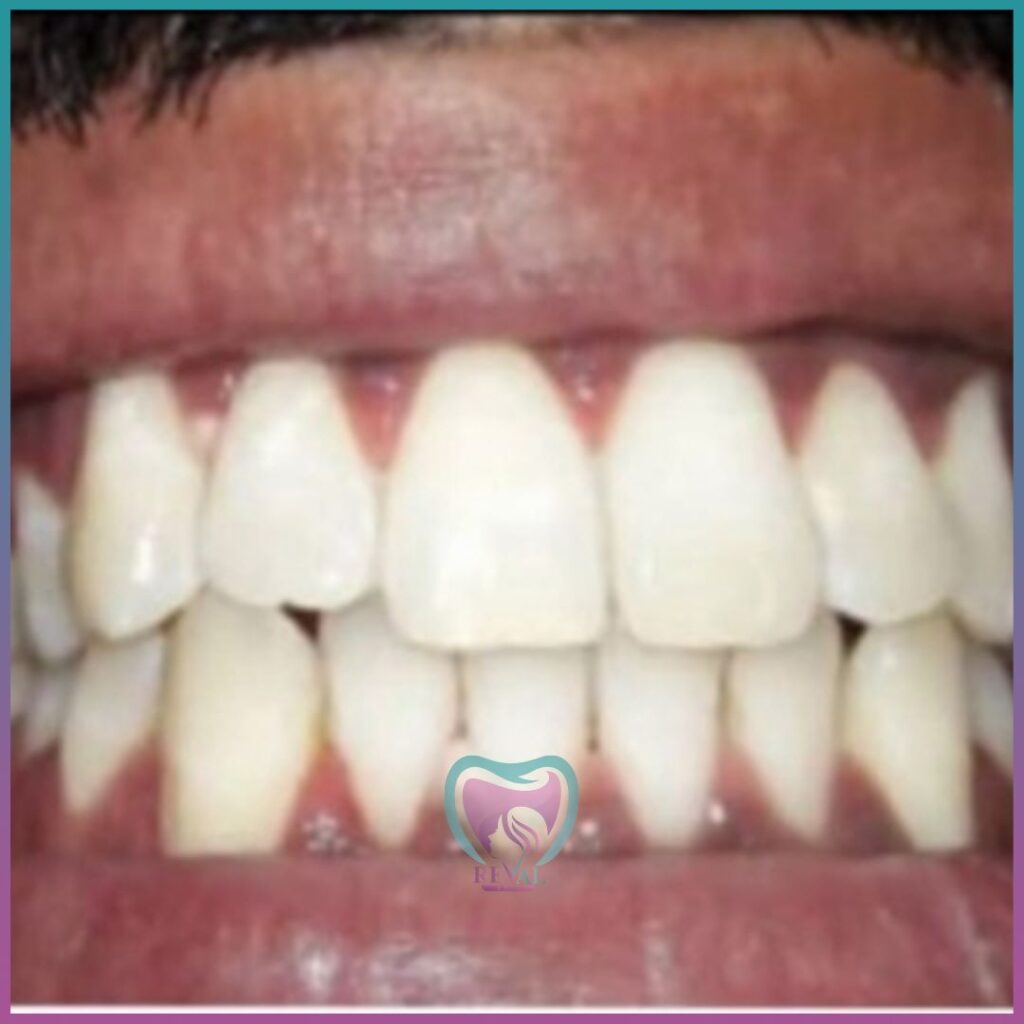 أسنان teeth