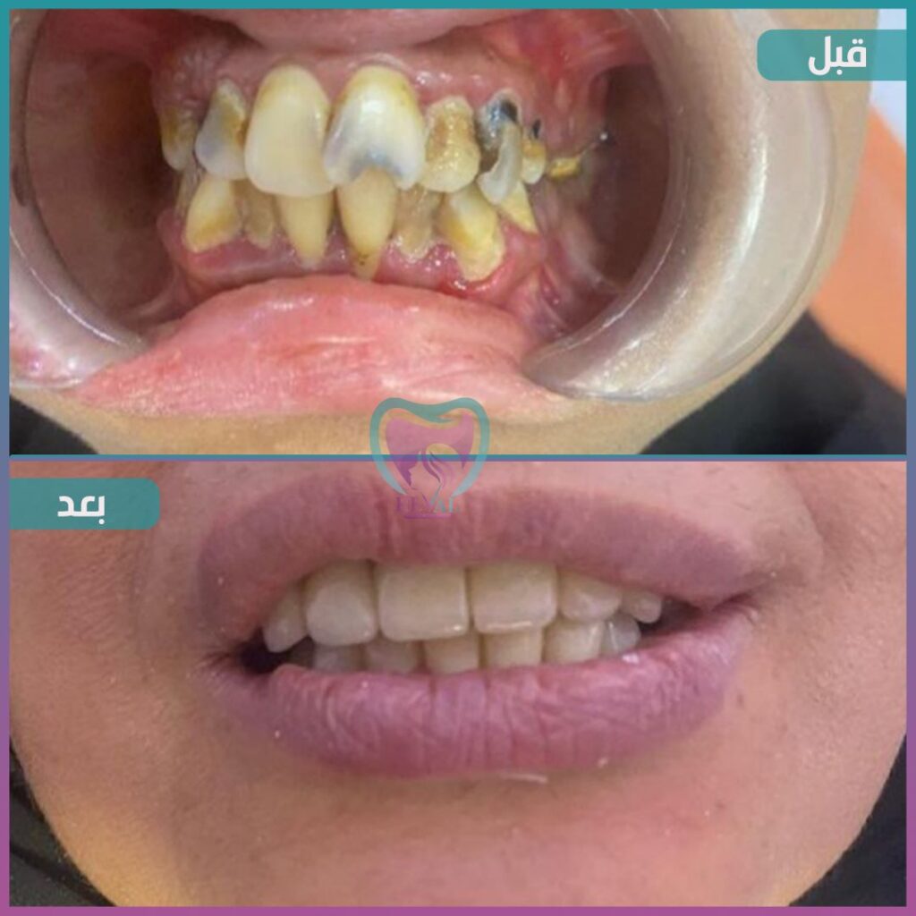 أسنان teeth