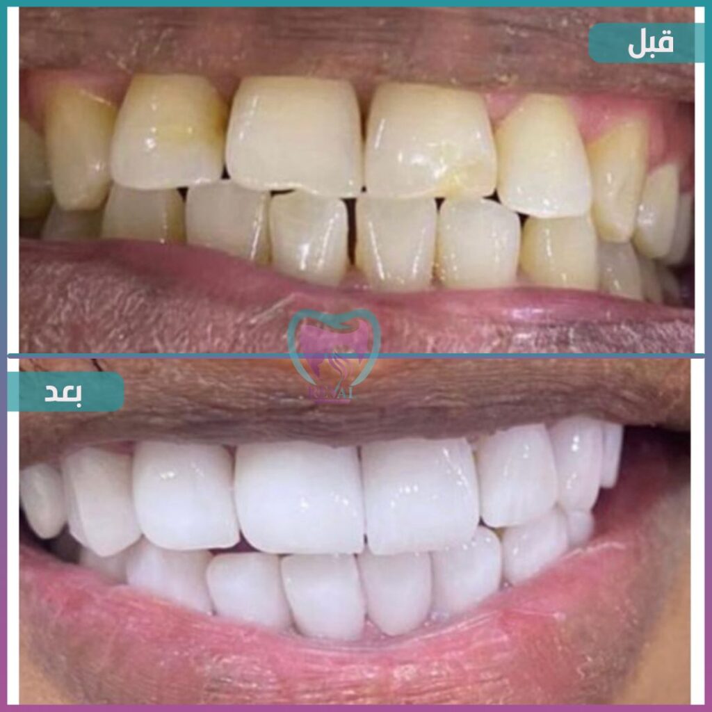 أسنان teeth