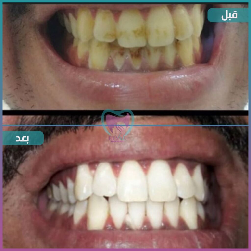 أسنان teeth