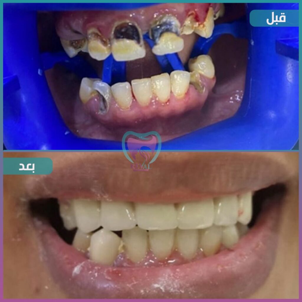 أسنان teeth