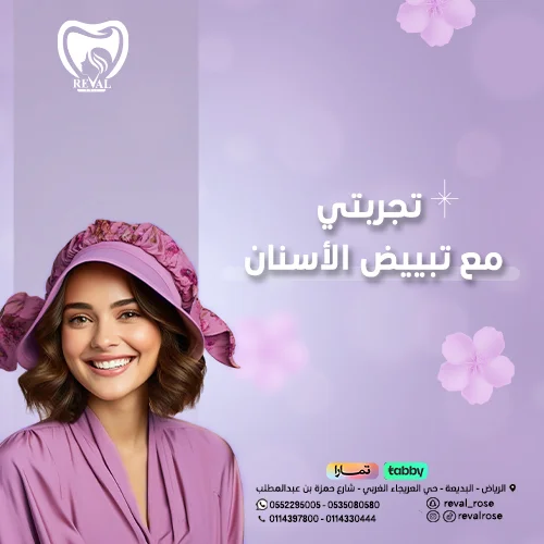 تجربتي مع تبييض الأسنان بالليزر