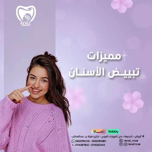 فوائد تبييض الاسنان بالليزر