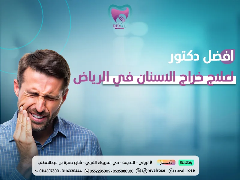 أفضل دكتور لعلاج خراج الأسنان في الرياض