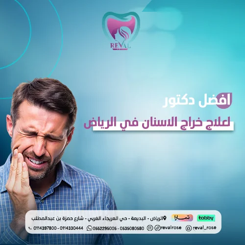أفضل عيادة أسنان لعلاج الخراجات
