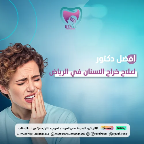 كيف أختار أفضل دكتور لعلاج خراج الأسنان في الرياض