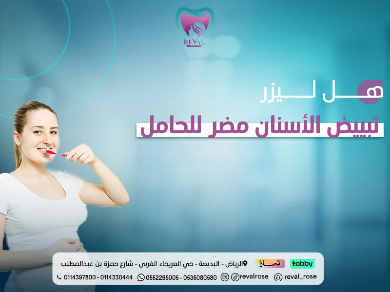 هل ليزر تبييض الأسنان مضر للحامل