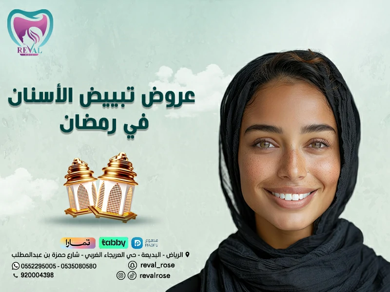 عروض تبييض الأسنان في رمضان – احصل على ابتسامة مشرقة بأسعار مميزة بالرياض