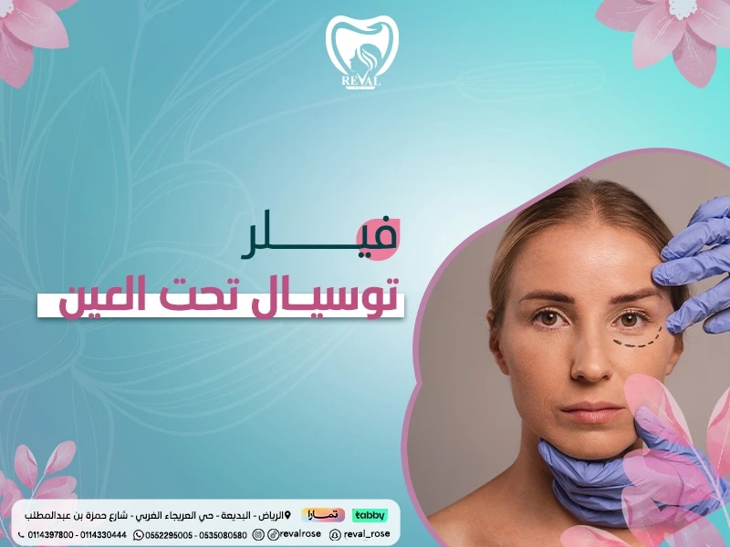 فيلر توسيال تحت العين