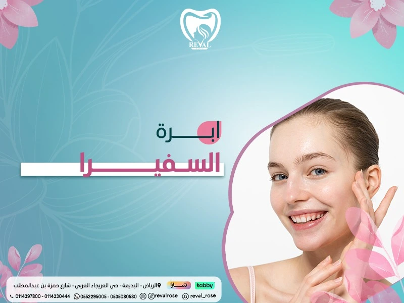  إبرة السفيرا..نصائح قبل وبعد تجربتي مع إبرة السفيرا