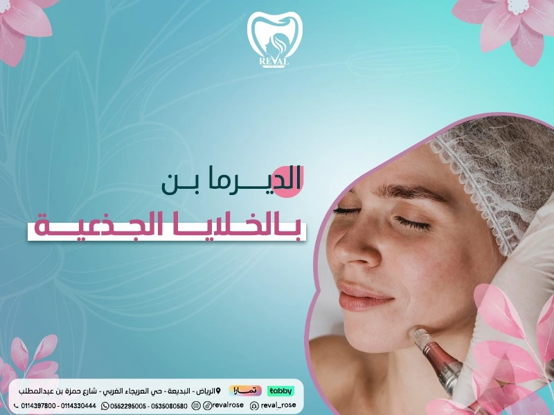الديرما بن بالخلايا الجذعية: اسرار تجديد البشرة مع تجربتي مع جلسات ديرما بن مع خلايا جذعية