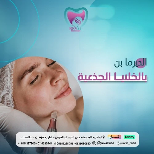 تجربتي مع جلسة ديرما بن بالخلايا الجذعية
