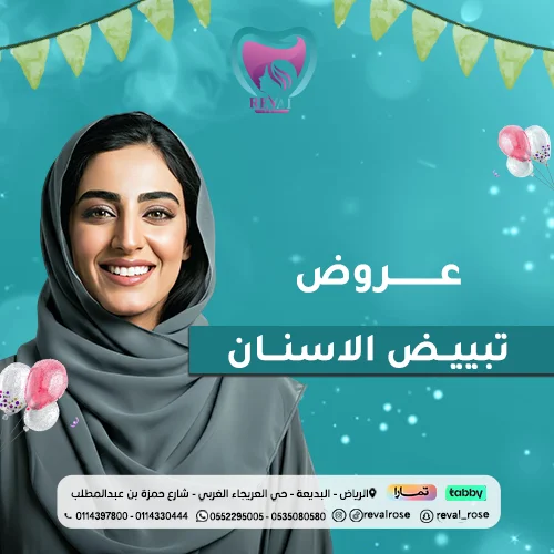 عروض تبييض الأسنان في عيد الأضحى بالرياض