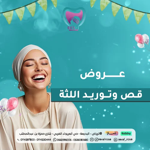 عروض قص وتوريد اللثة في عيد الاضحى