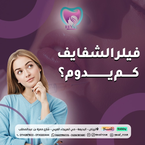 فيلر الشفايف كم يدوم؟ نصائح لكل انواع فيلر الشفاه لنتائج تدوم طويلاً