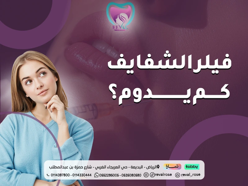 فيلر الشفايف كم يدوم