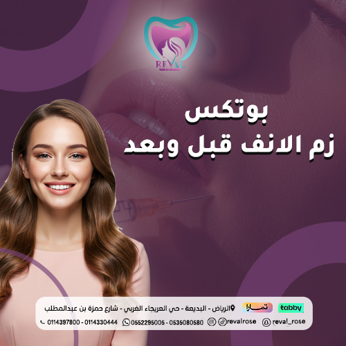 حقن بوتكس زم الأنف قبل وبعد