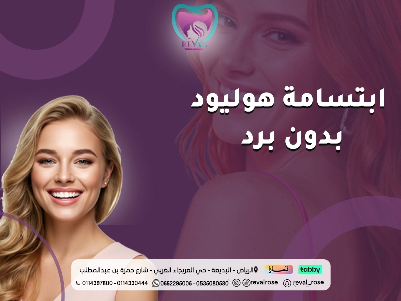 ابتسامة هوليود بدون برد: عروض تركيب ابتسامة هوليود بدون نحت بالرياض