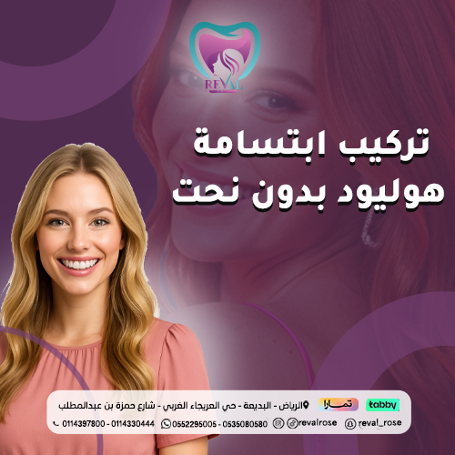 تركيب ابتسامة هوليود بدون نحت
