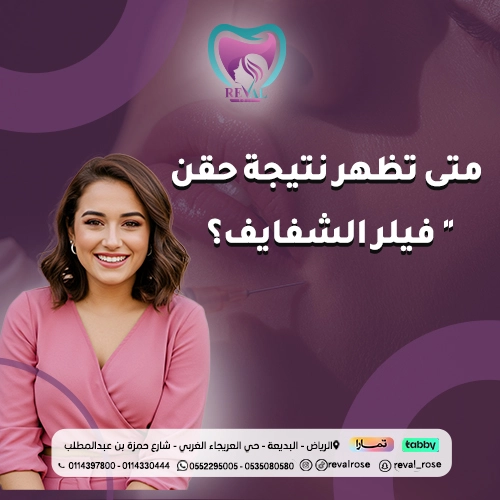 تجربتي مع حقن فيلر الشفايف - متى تظهر نتيجة حقن فيلر الشفايف