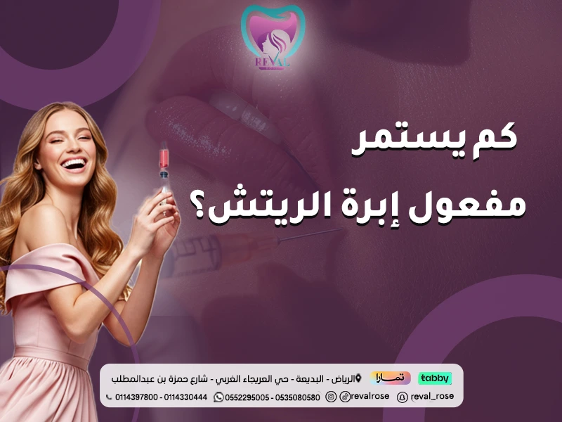 كم يستمر مفعول إبرة الريتش؟ دليلك لنتائج تدوم طويلًا في الرياض