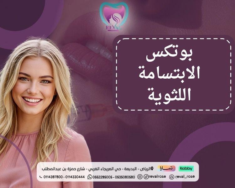 بوتكس الابتسامة اللثوية: اسرار حقن بوتكس ضحكة لثوية