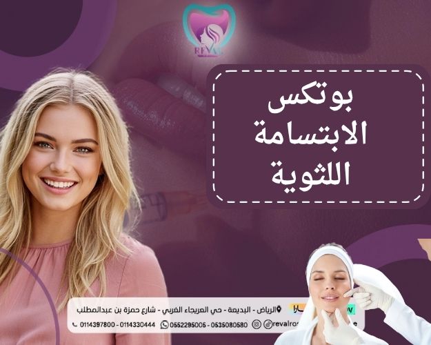 بوتكس الابتسامة اللثوية قبل وبعد