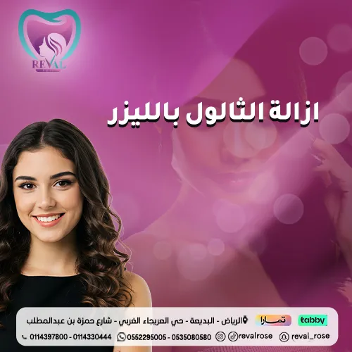 تجربتي مع ازالة الثالول بالليزر