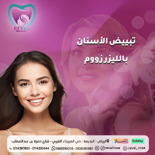 تجربتي مع تبييض الأسنان بالليزر زووم