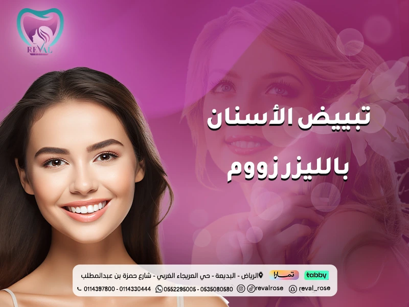 تبييض الأسنان بالليزر زووم