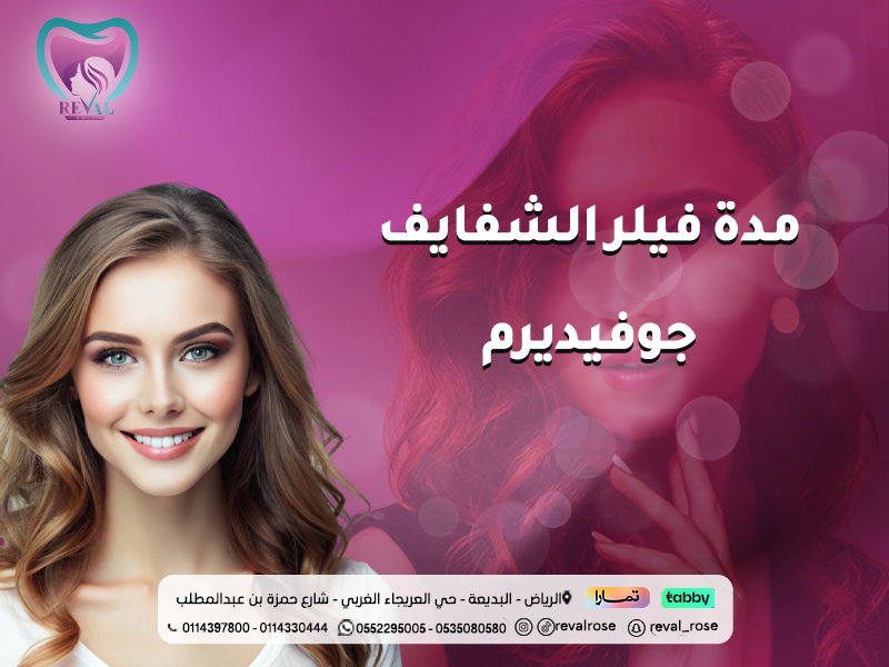 مدة فيلر الشفايف جوفيديرم: كل ما تحتاجين معرفته لتحقيق نتائج تدوم أطول
