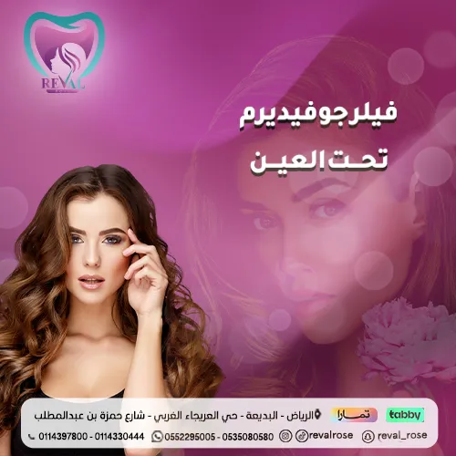 تجربتي مع فيلر جوفيديرم تحت العين