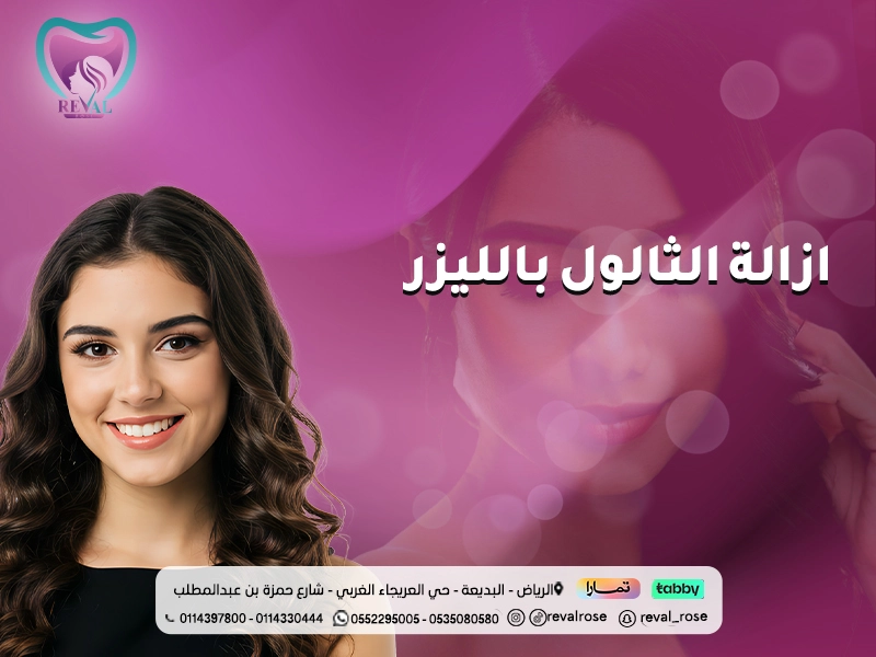  ازالة الثالول بالليزر: متى تسقط الثآليل بعد الليزر؟