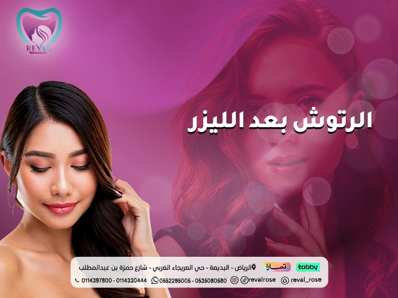 الرتوش بعد الليزر: أهميتها، خطواتها، وأسرار لنتائج افضل