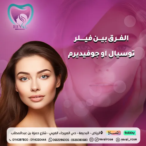 افضل فيلر توسيال او جوفيديرم للشفايف
