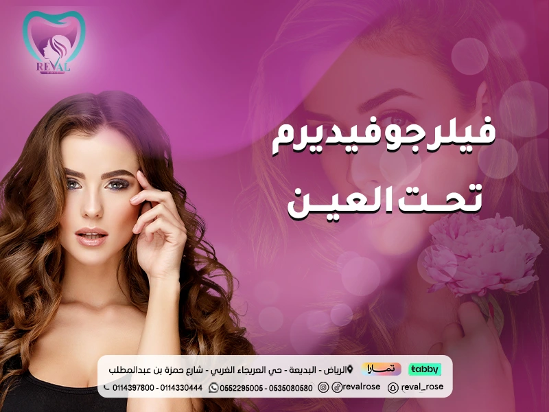 فيلر جوفيديرم تحت العين: دليلك لعلاج الهالات والتجاويف بالرياض