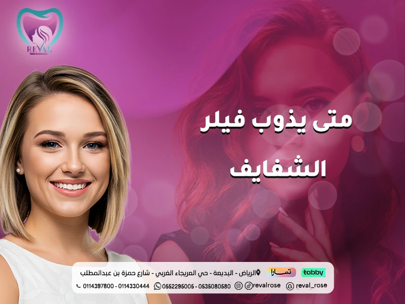 متى يذوب فيلر الشفايف؟ دليلك لفهم مدة بقاء حقن الفيلر ونتائجها