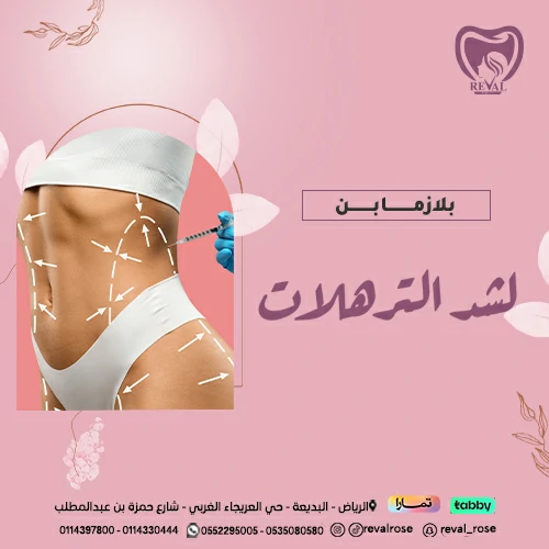 تجربتي مع بلازما بن لشد الترهلات