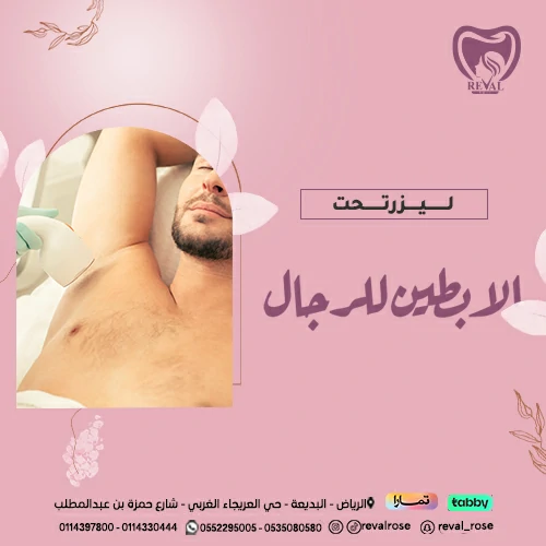 تجربتي مع ليزر تحت الابطين للرجال