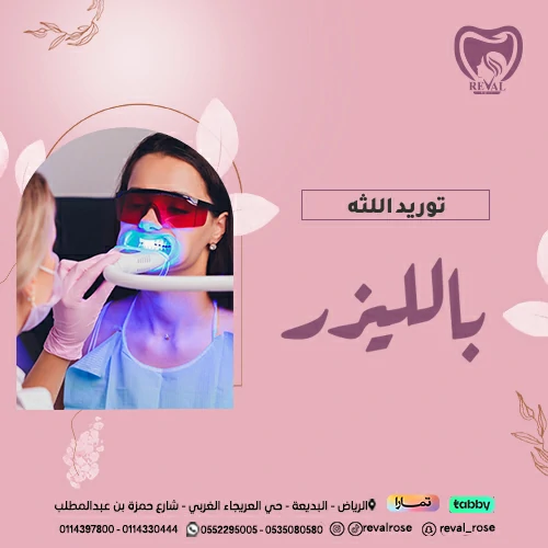 تجربتي مع توريد اللثة بالليزر