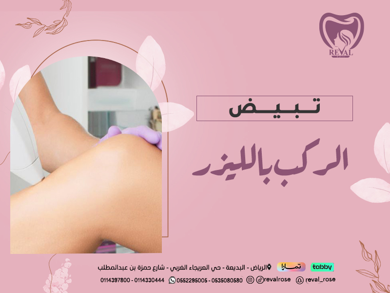 تبييض الركب بالليزر : اسرار ونصائح قبل جلسة تفتيح الركب والأكواع
