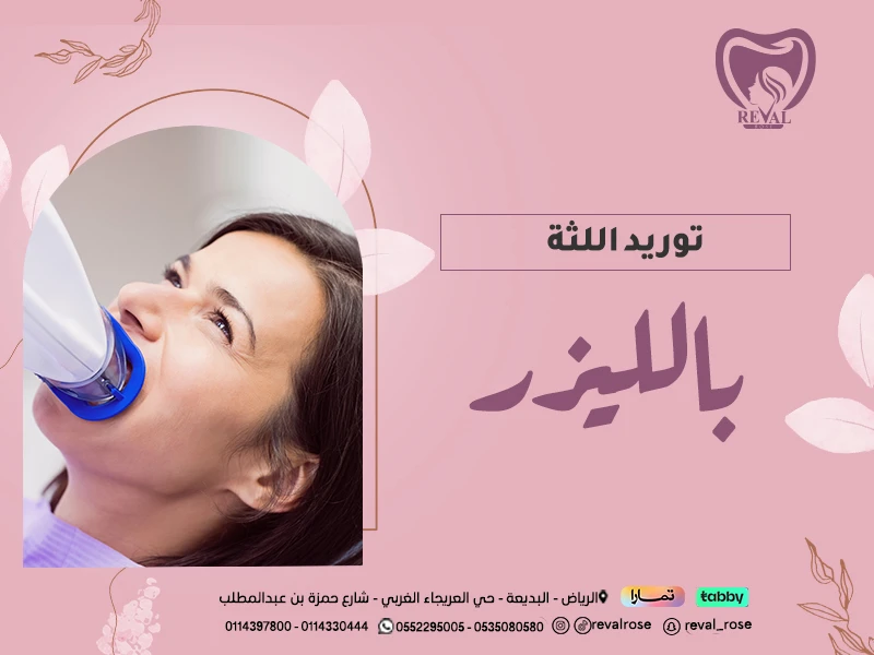 توريد اللثة بالليزر: أفضل عيادة اسنان لتوريد اللثة