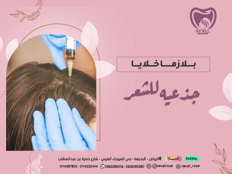 بلازما خلايا جذعيه للشعر: أفضل عروض بلازما الخلايا الجذعية 