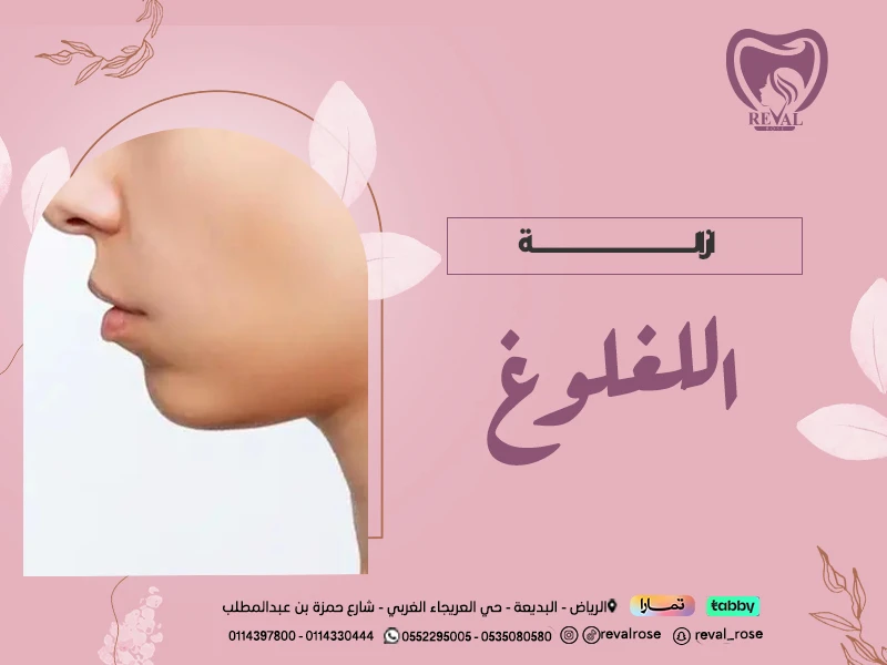 ازالة اللغلوغ أو الذقن المزدوج: متى تظهر نتيجة شفط اللغلوغ؟
