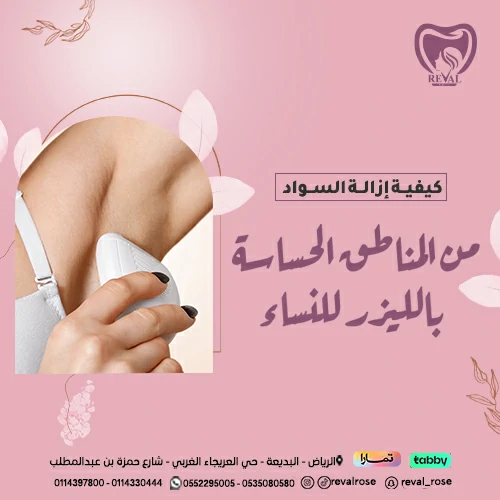 تجربتي مع إزالة السواد من المناطق الحساسة بالليزر للنساء