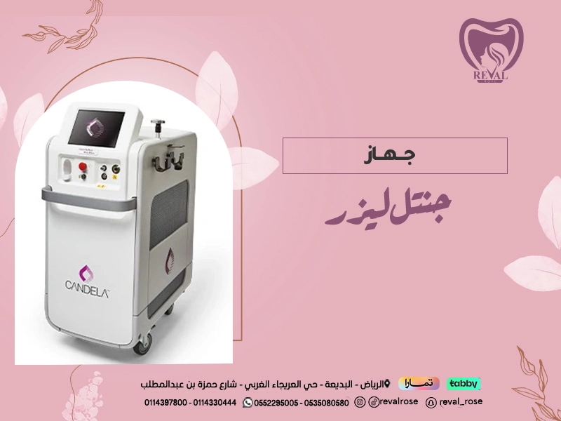 جهاز جنتل ليز: أفضل اجهزة إزالة الشعر بالليزر في الرياض