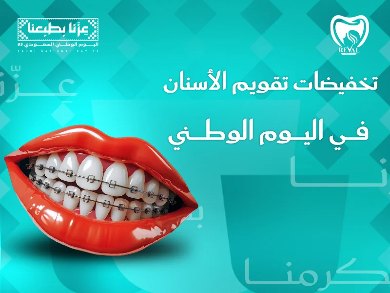 تخفيضات تقويم الأسنان اليوم الوطني: دليلك الشامل للحصول على ابتسامة رائعة بأسعار استثنائية