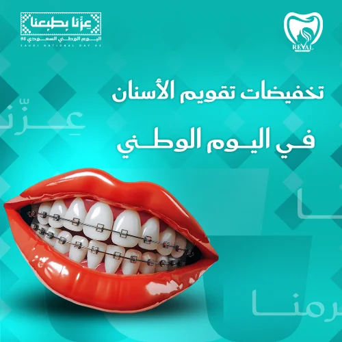 عروض تقويم الأسنان اليوم الوطني