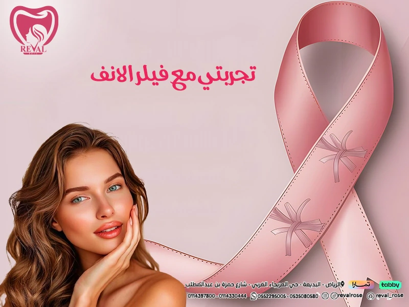 فيلر الأنف: كم يدوم و تجربتي مع حقن فيلر الأنف