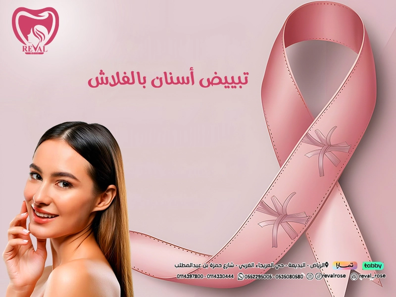 تجربتي مع تبييض أسنان بالفلاش: اسرار تبييض الاسنان بالفلاش الألماني